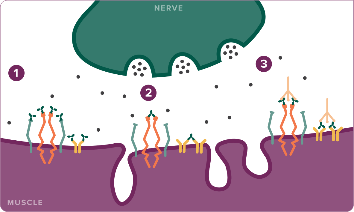 IgG autoantibodies disrupt neurotransmission in 3 ways